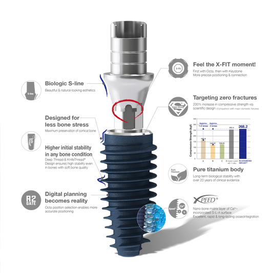 Blue Diamond Implants (Deep Threads)