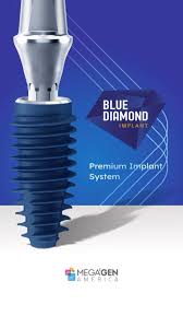 Blue Diamond Implants (Regular Threads)